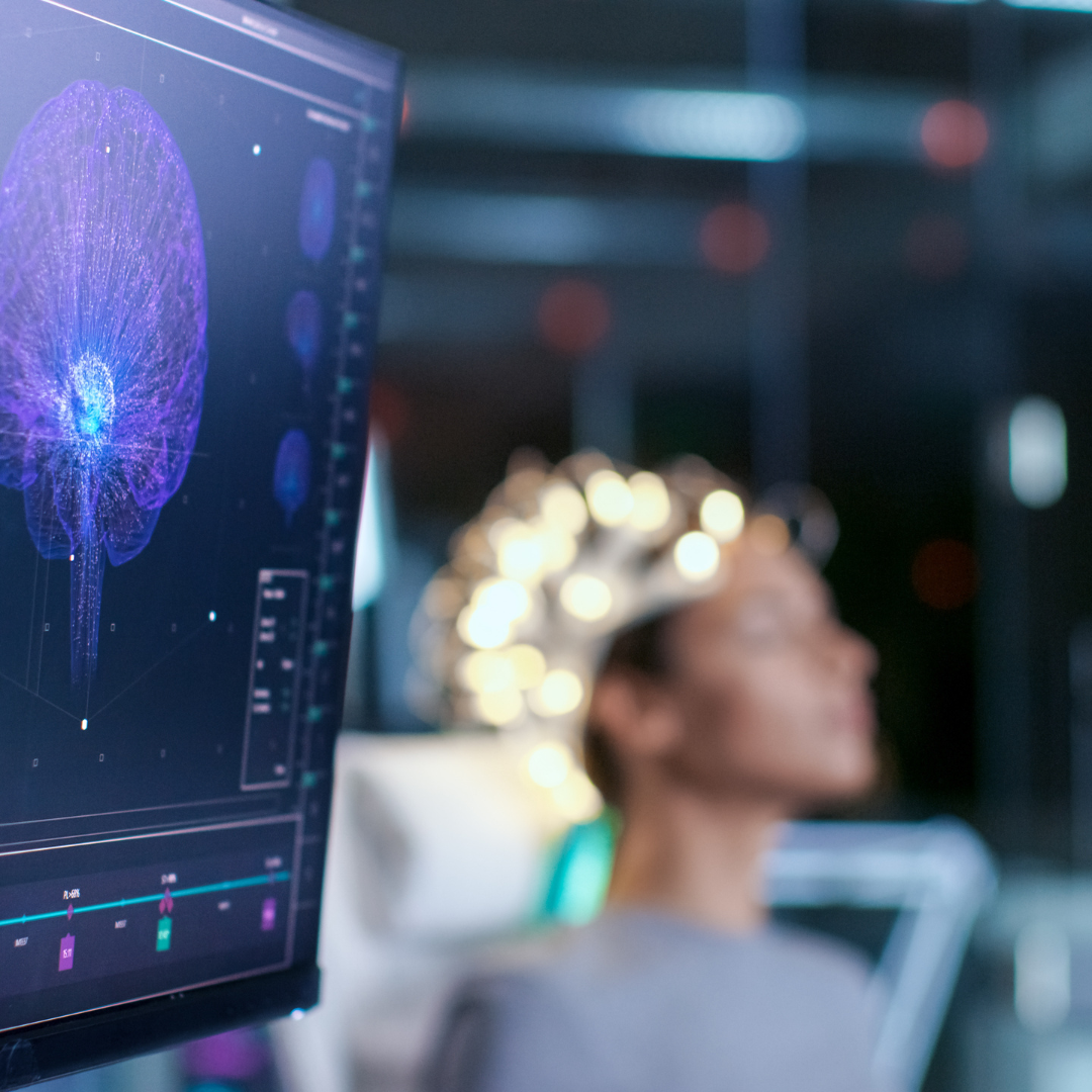 what-is-an-eeg-open-medicine-foundation