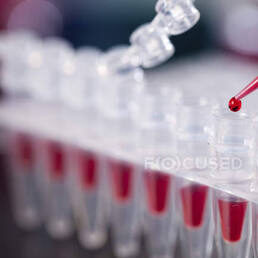 Close-up of a pipette dropping a liquid sample into a strip of clear laboratory microcentrifuge tubes.